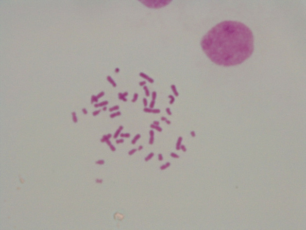 Male Chromosomes Slides - Male Chromosomes 10 1000X